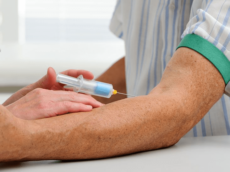 Blood Smear Test: Purpose, Process, and Interpretation