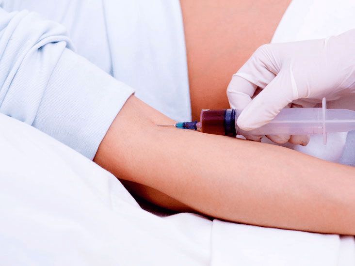 Epstein-Barr Virus (EBV) Test: Understanding Its Purpose, Process, and Potential Risks