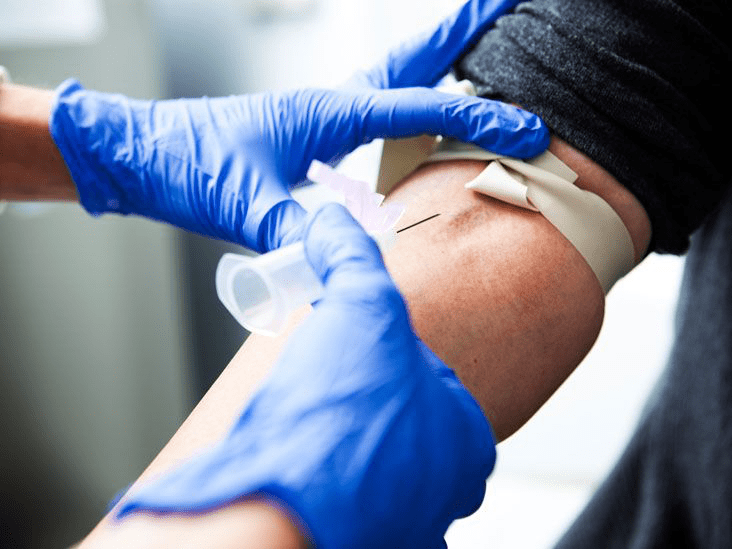 Serum Iron Test: Understanding Its Purpose, How It's Done, and What the Results Mean