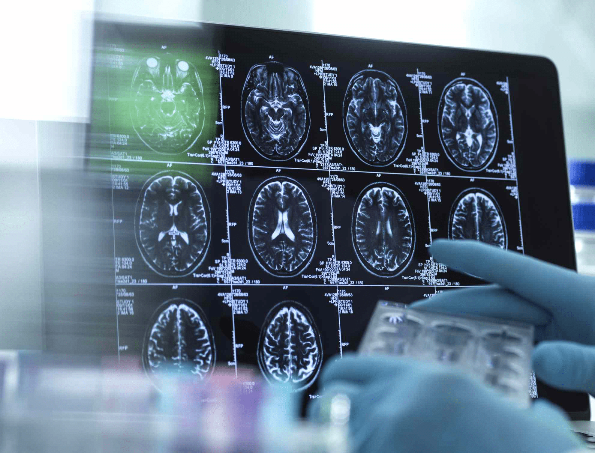 Увлекательные Карьеры в Области Когнитивной Психологии: Откройте Для Себя Свои Возможности