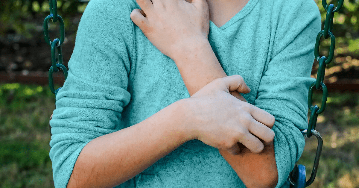 2025 Guide: Bugs That Burrow Under Skin - Symptoms, Treatment & Prices