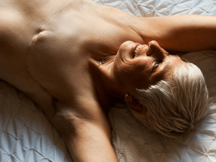 Эффективные хирургические методы лечения рака груди