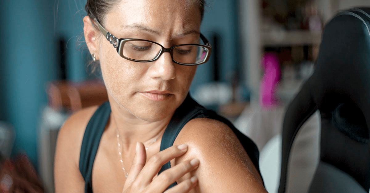 Почему у меня появляются синяки без причины?