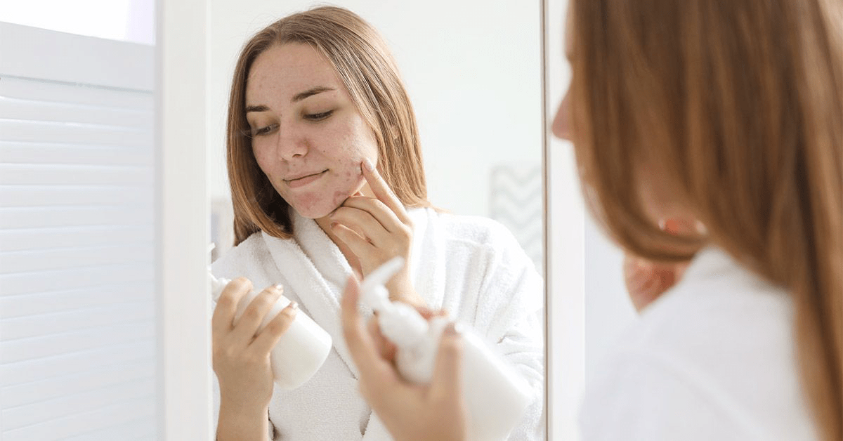 Quruq Teri va Akne: Sabablari, Davolash Usullari va Uy Sharoitida Qarshi Kurash