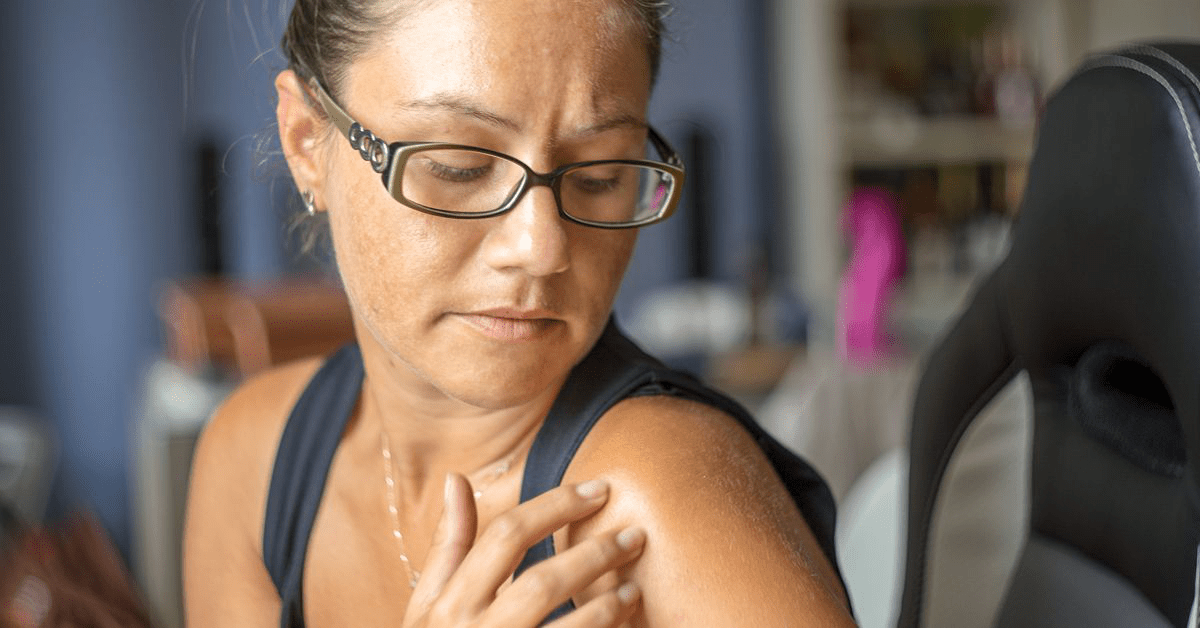 2025 Guide: Painful Moles vs. Melanoma Signs – What Skin Changes Should You Watch For?