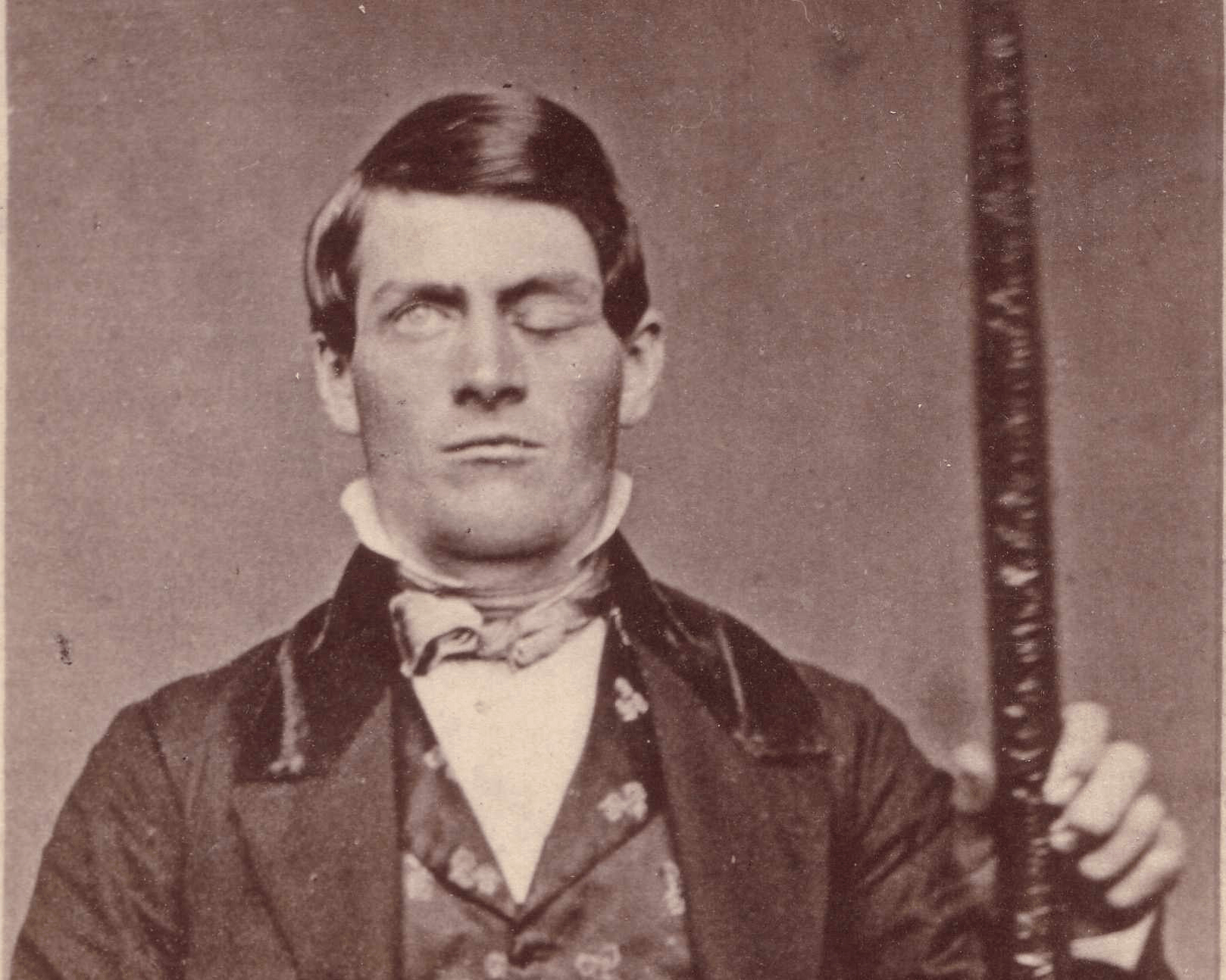 Phineas Gage: Miya Yaralanishi va Psixologiyaga Ta'siri