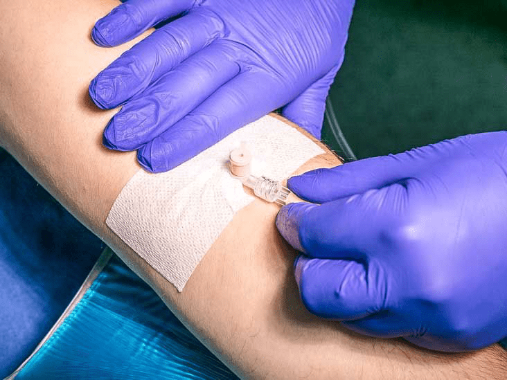 Центральные венозные катетеры: что нужно знать перед началом химиотерапии