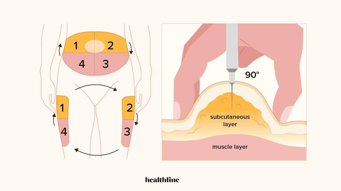 Visual guide to insulin injection areas in subcutaneous fat of abdomen and thighs, highlighting areas to avoid muscle penetration