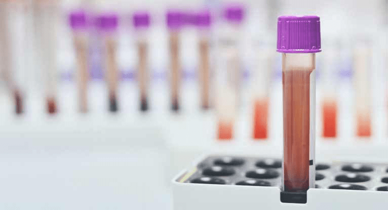 2025 Guide: Understanding False Positive HIV Test Results and What to Do Next