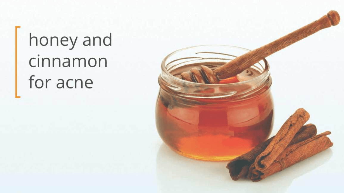 Harnessing the Power of Honey and Cinnamon to Combat Acne