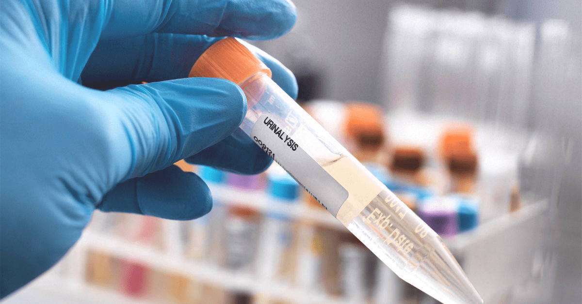 Urine DNA Testing in 2025: Can You Extract DNA from Urine Samples and What’s the Cost?