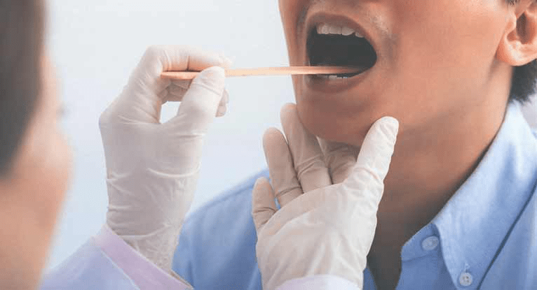 Почему появляются белые пятна на миндалинах: причины и методы лечения