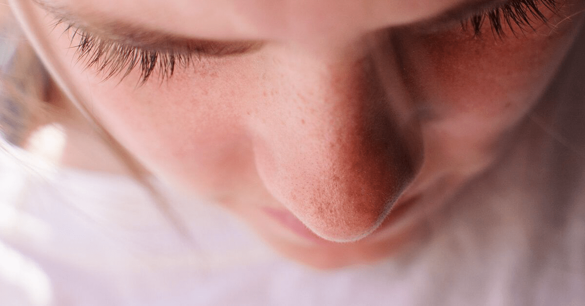 Чёрные точки и белые угри: раскрываем отличия и эффективные методы борьбы