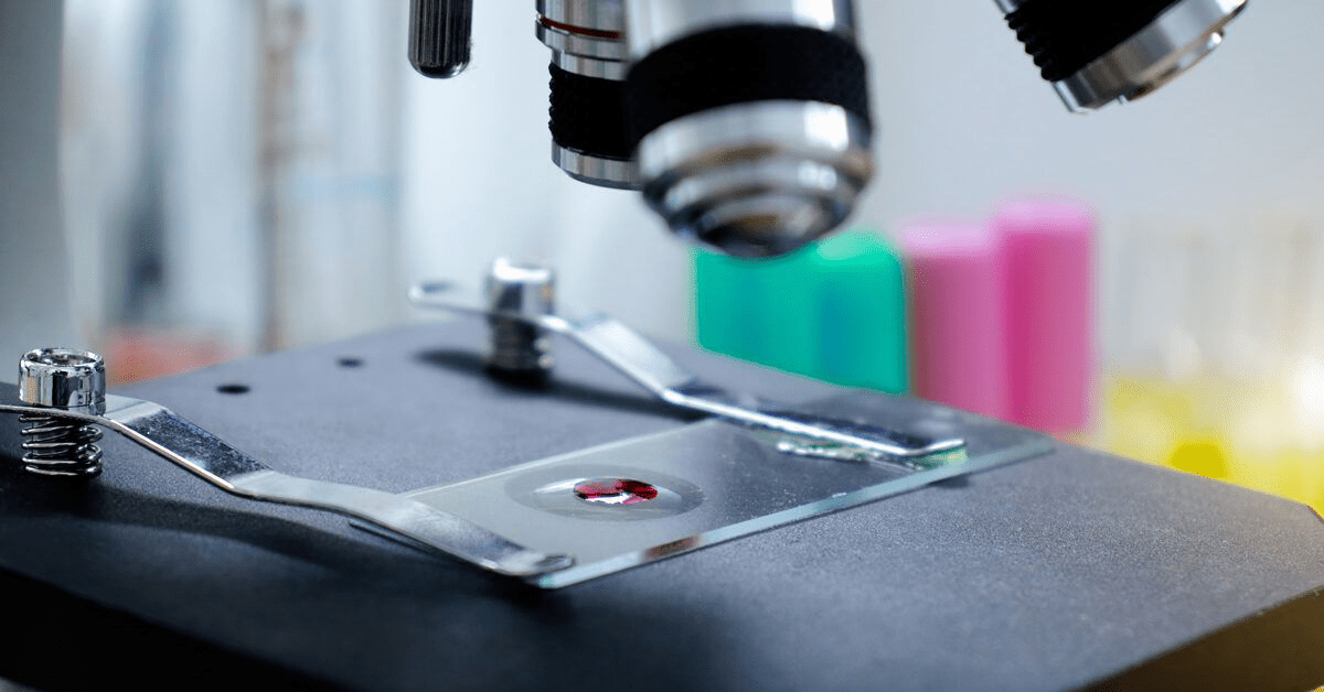 Узнайте больше о видах миелодиспластических синдромов: ключ к эффективному лечению