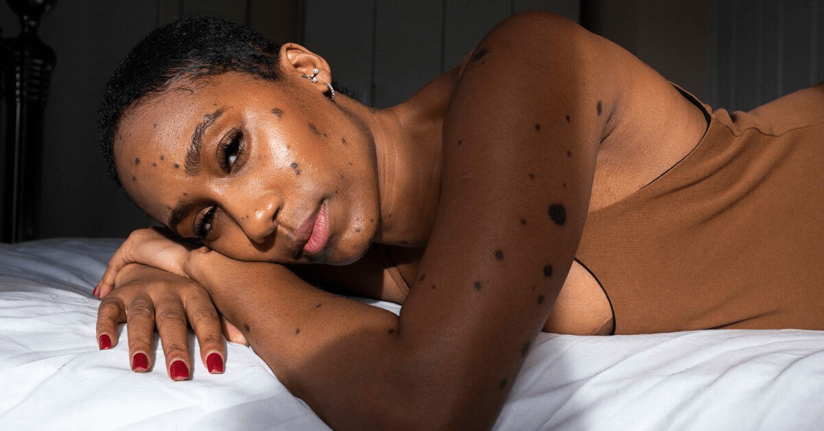 Почему глаза слезятся при лежании: причины и способы борьбы