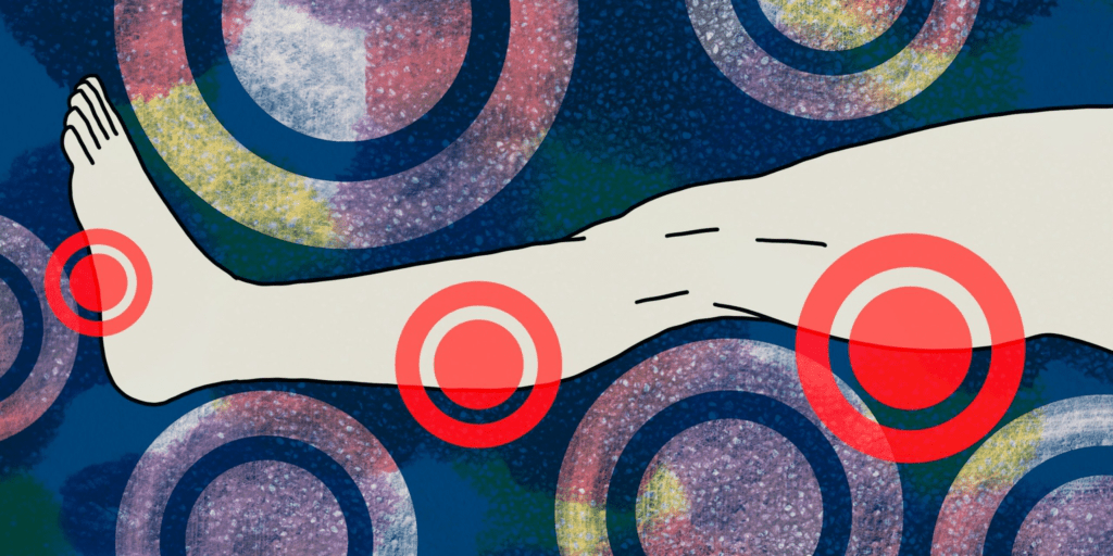 Эффективные методы борьбы с судорогами в ногах: что нужно знать каждому