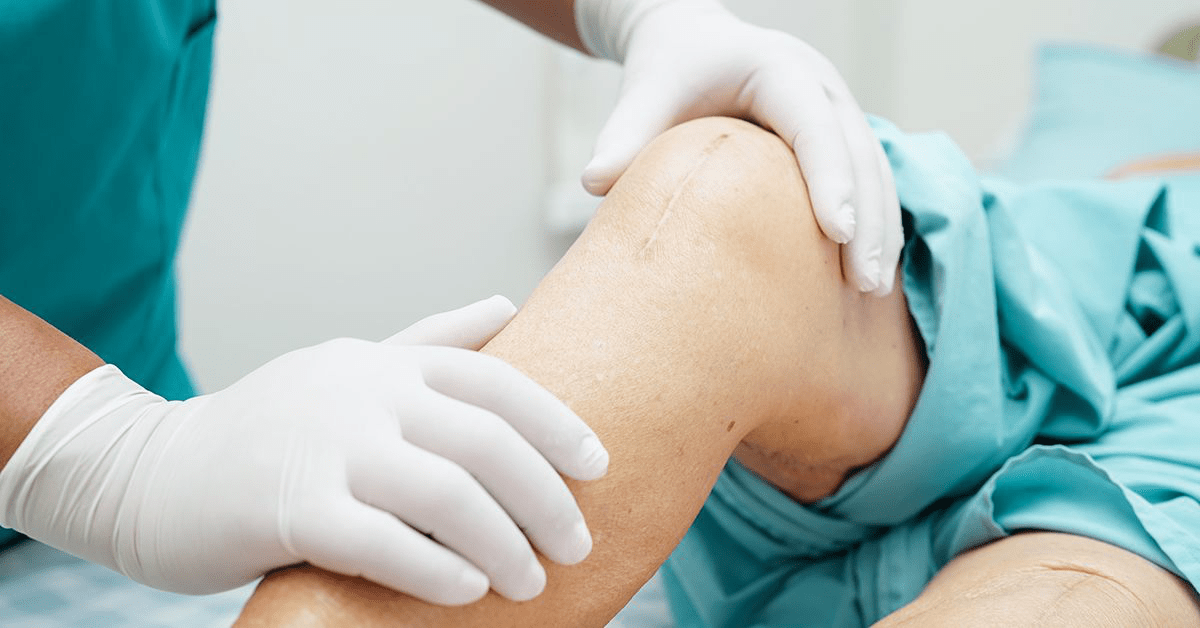 Ответы на главные вопросы о замене коленного сустава