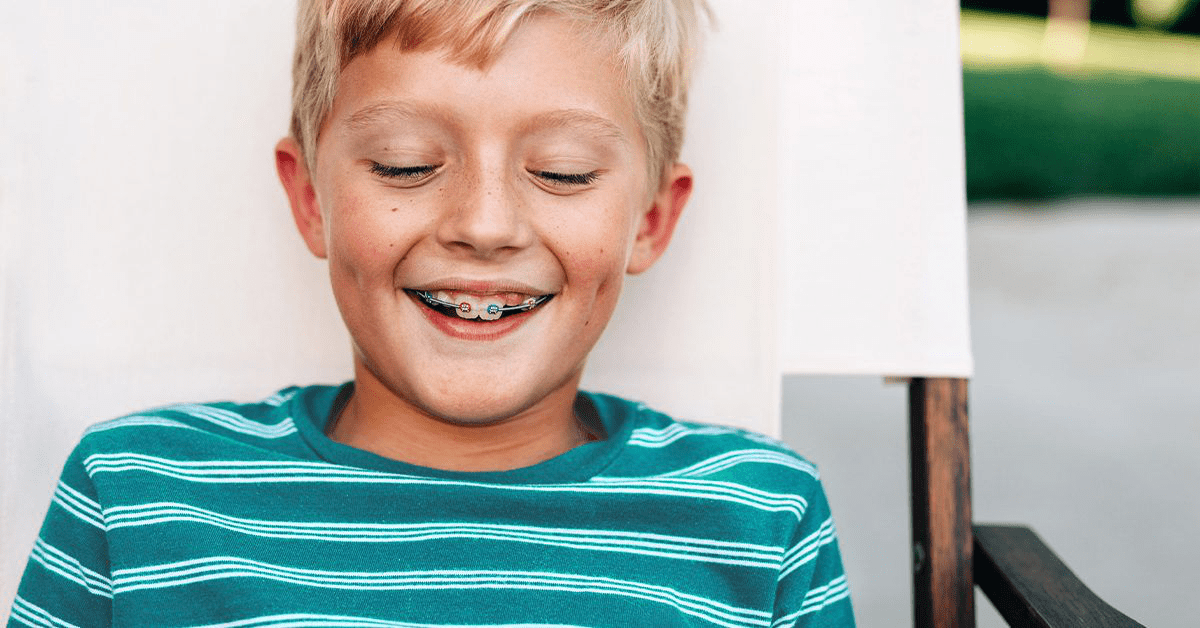 Effective Teeth Whitening Solutions for Braces Wearers