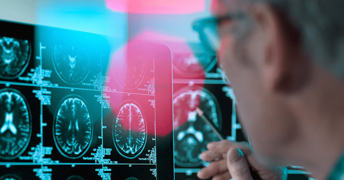 Раскрывая тайны болезни Паркинсона: что известно и что остается загадкой