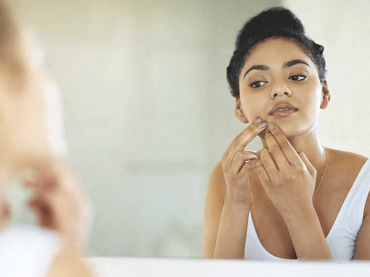 Эффективные способы борьбы с акне на линии челюсти