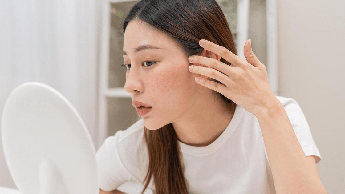 Эффективная защита кожи со шрамами от солнца: советы и рекомендации