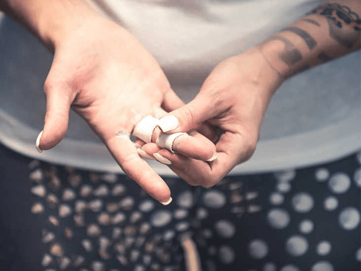 Как распознать и лечить кровяные волдыри: эффективные советы и рекомендации