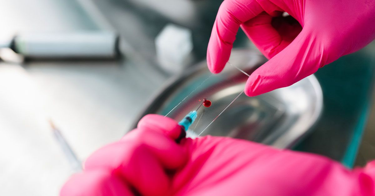 Как распознать рак почки: роль анализа крови и другие методы диагностики