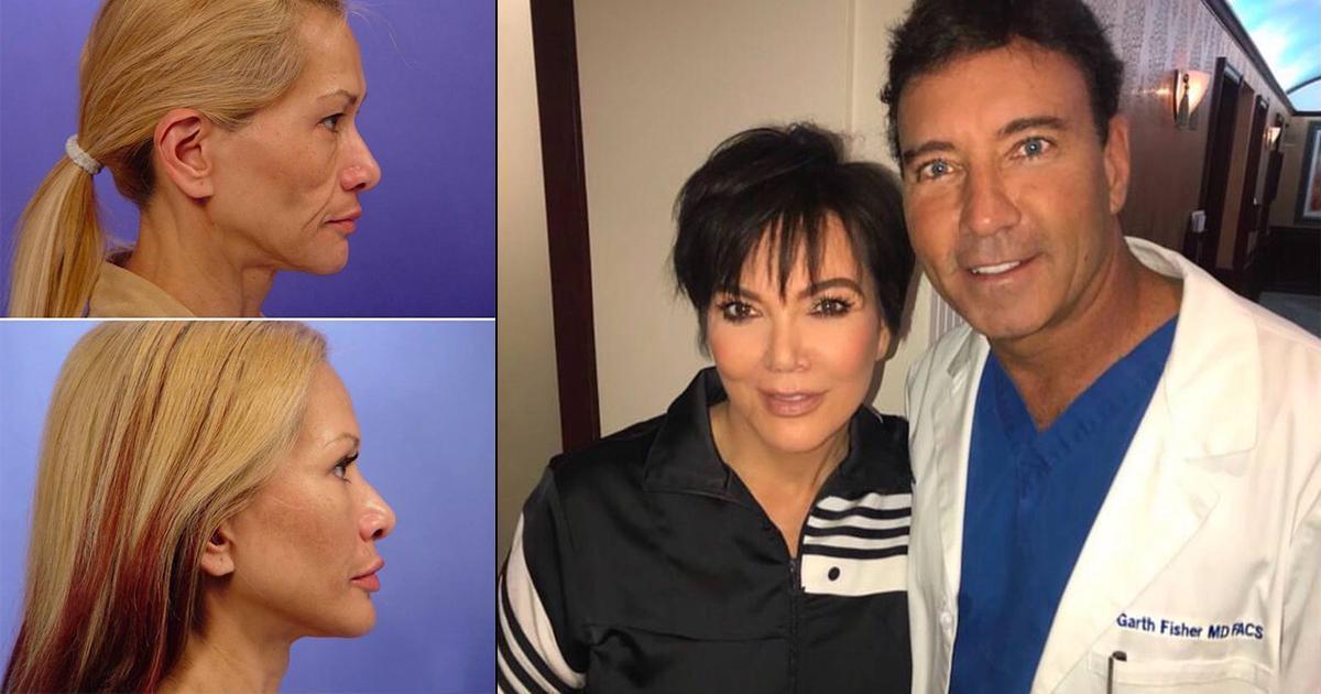 Топ пластических хирургов Голливуда: искусство естественной красоты