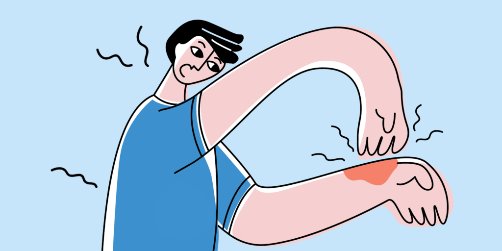 Discover the True Causes of Hives and How to Effectively Manage Them