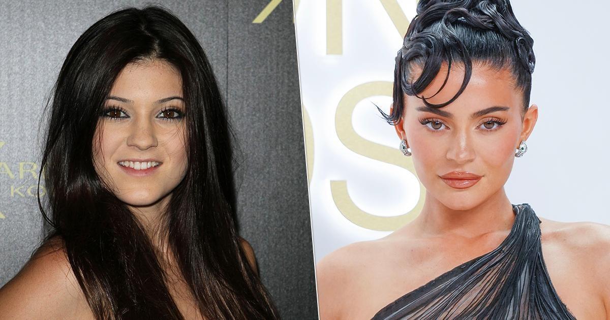 Как Кайли Дженнер меняет взгляд на красоту: стремление к естественности в мире пластики