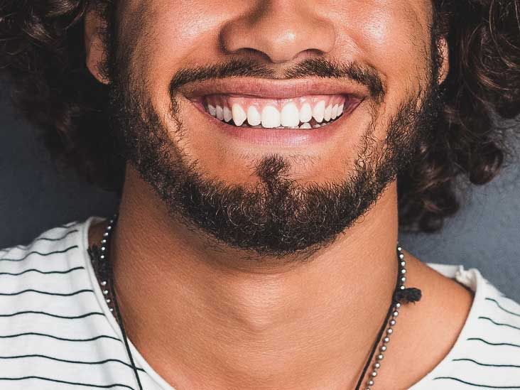 Белые пятна на зубах: причины, лечение и профилактика