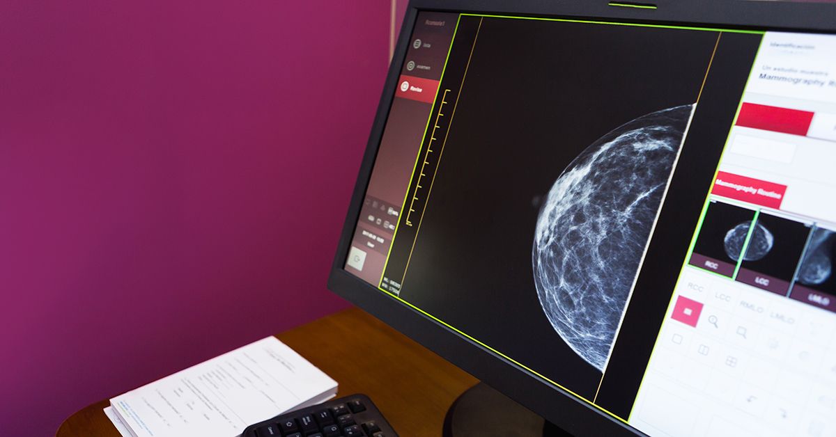 Современный взгляд на томосинтез: преимущества 3D-маммографии для ранней диагностики рака груди