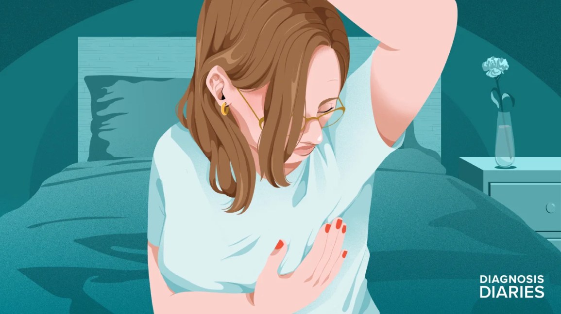 Иллюстрация Анн Пьетранжело, обнаруживающей уплотнение