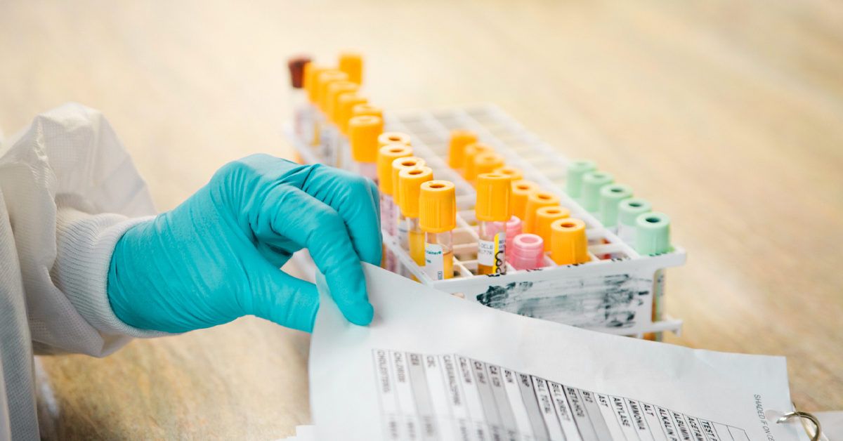 COVID-19 Testlari va Medicare: Bilishingiz Kerak Bo'lgan Hammasi