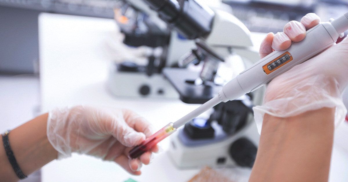 Serum Myoglobin Test 2025: Cost, Procedure & What Your Results Mean