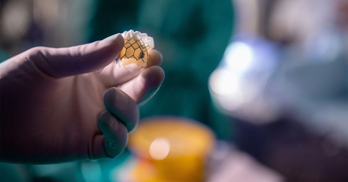 Как транскатетерная замена аортального клапана меняет жизнь: преимущества и особенности процедуры