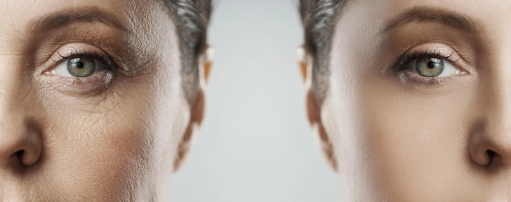 Tanda kekurangan kolagen