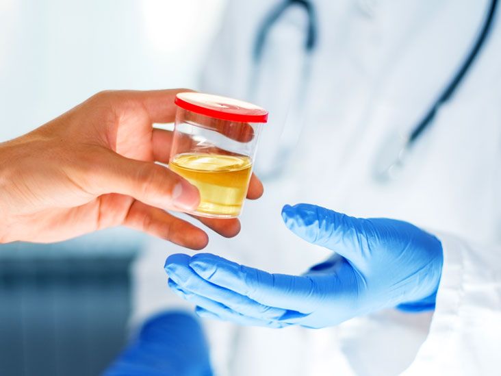 Microalbuminuria Test 2025: Cost, Procedure & What Your Results Reveal About Kidney Health