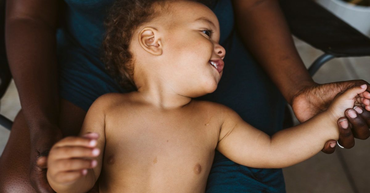 Как защитить малыша от герпесных пузырьков и что делать при первых признаках