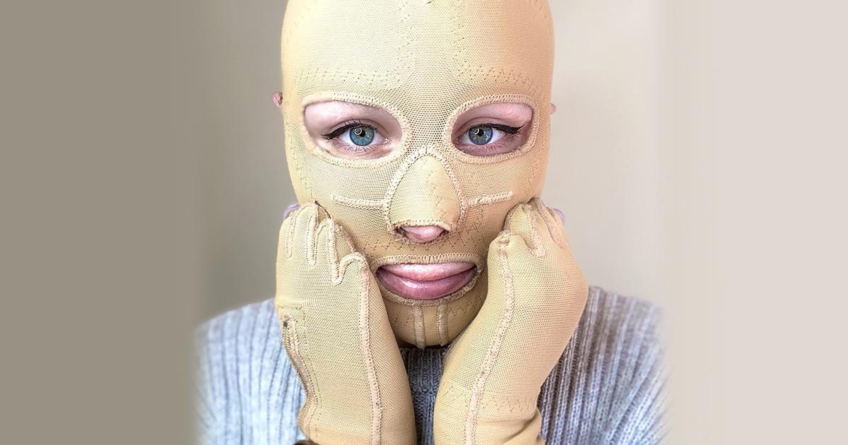 История невероятного выживания: женщина, пережившая извержение вулкана на острове Уайт-Айленд