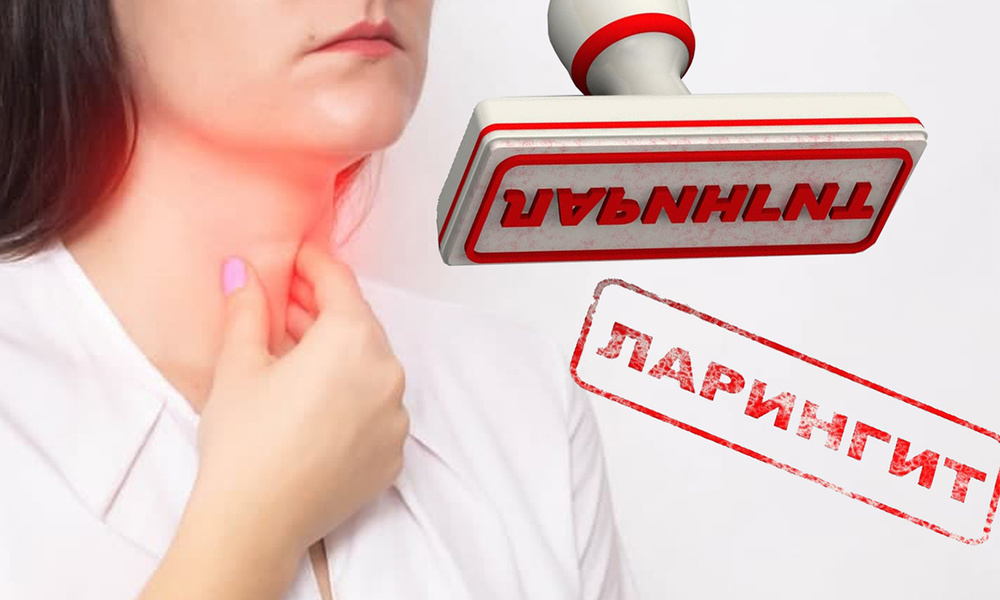 Rahasia Mengatasi Radang Pita Suara dengan Cara Alami dan Efektif