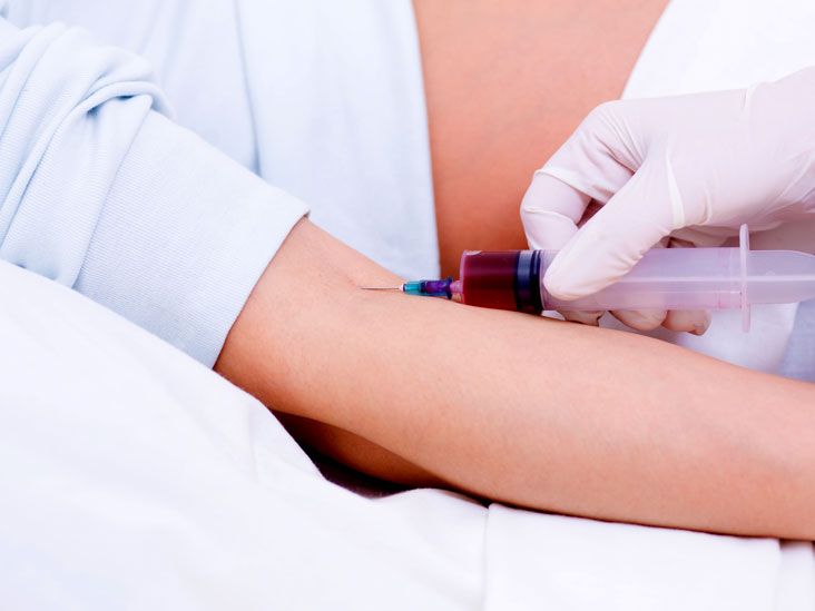 Epstein-Barr Virus (EBV) Test 2025: Cost, Procedure, and What Your Results Mean