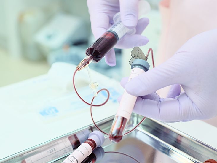 Qon Guruhingizni Qanday Aniqlash Mumkin: Oddiy va Samarali Yo‘llar