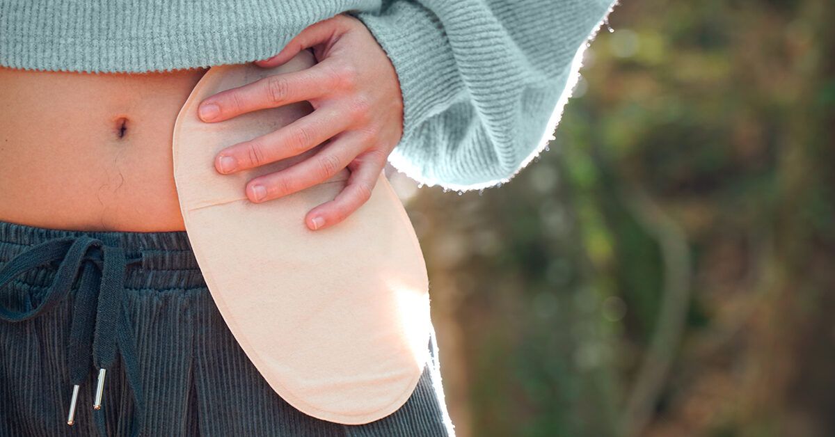 Cutaneous Urinary Diversion Explained: Modern Solutions for Urinary Tract Challenges