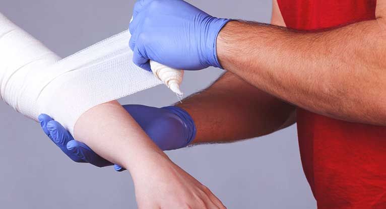 Panduan Lengkap Mengatasi dan Merawat Luka Bakar