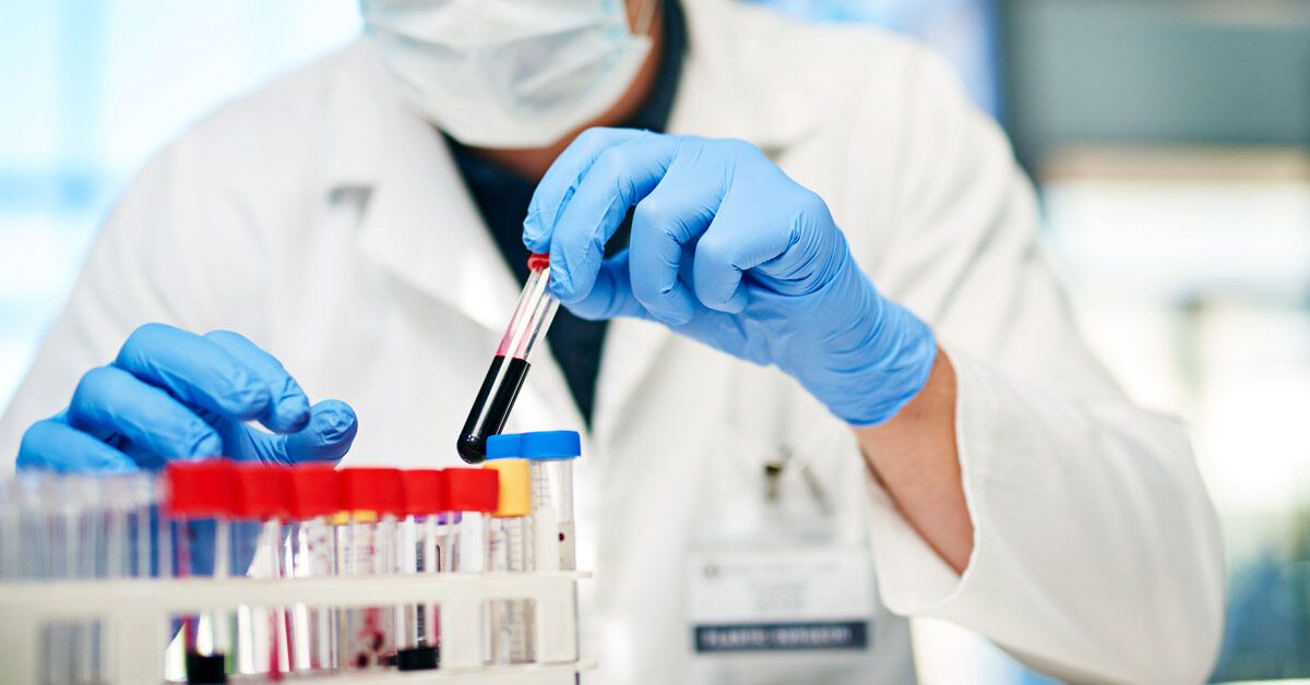 Antiphospholipid Syndrome: Key Symptoms and Modern Management Strategies