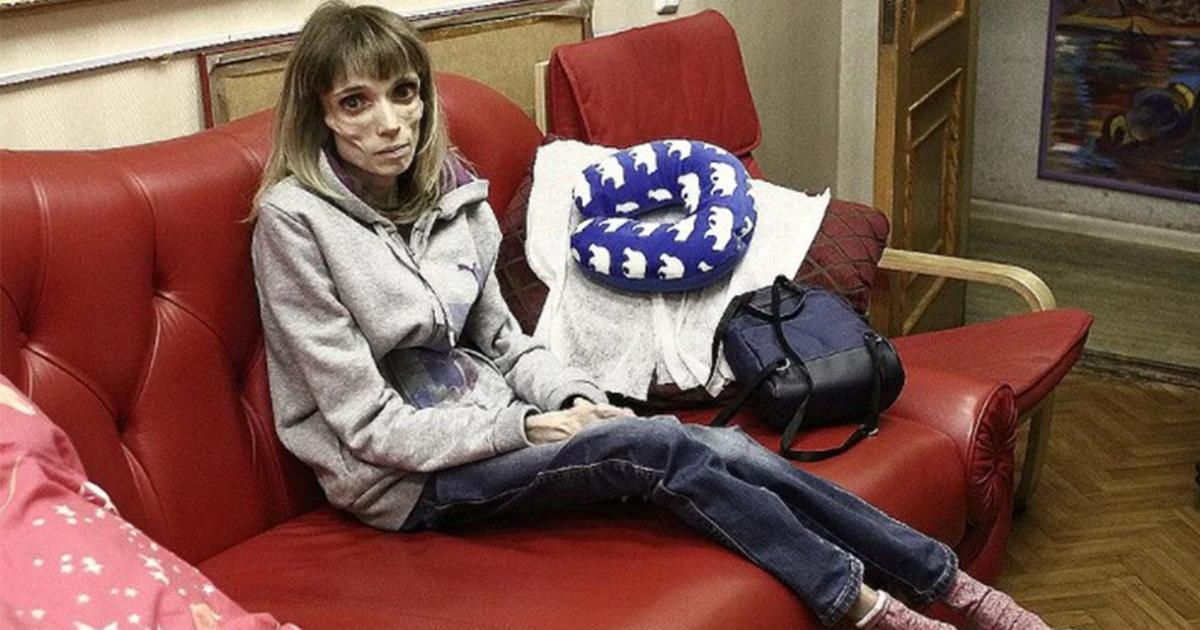 История Кристины Корягиной: борьба с анорексией и путь к жизни без ограничений