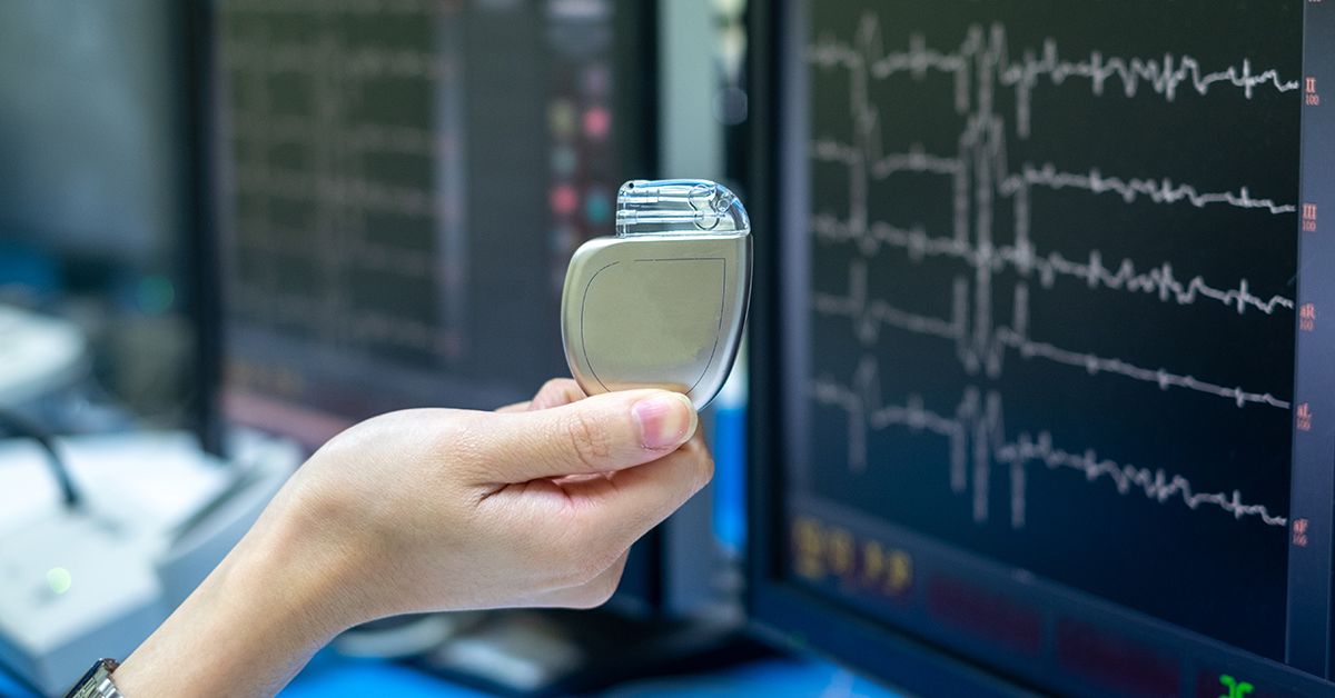 Эффективные методы лечения аритмии: что нужно знать каждому