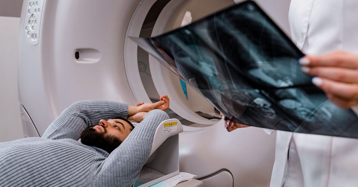 Effective Radiation Therapy for Esophageal Cancer: Benefits, Side Effects, and Treatment Insights