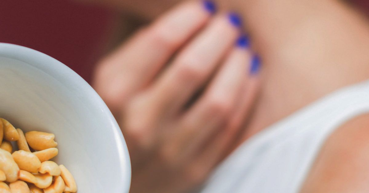 2025 Food Allergy Rash Guide: Symptoms, Treatments & Management Tips